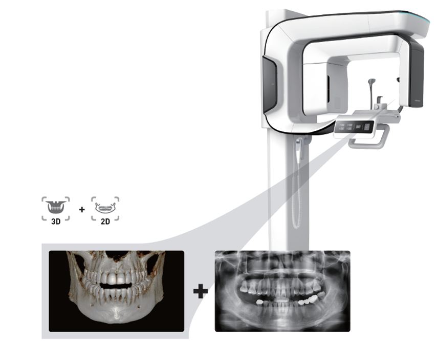 CBCT scanner with three-dimensional jaw and panoramic dental images